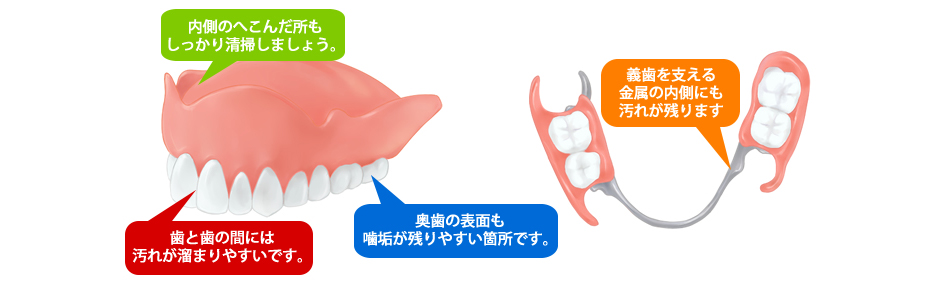 義歯(入れ歯)の清掃について